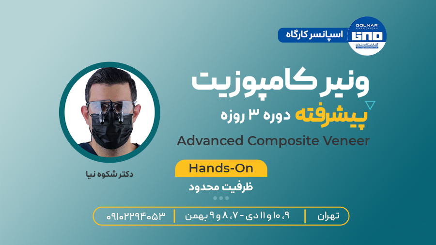 ونیر کامپوزیت پیشرفته